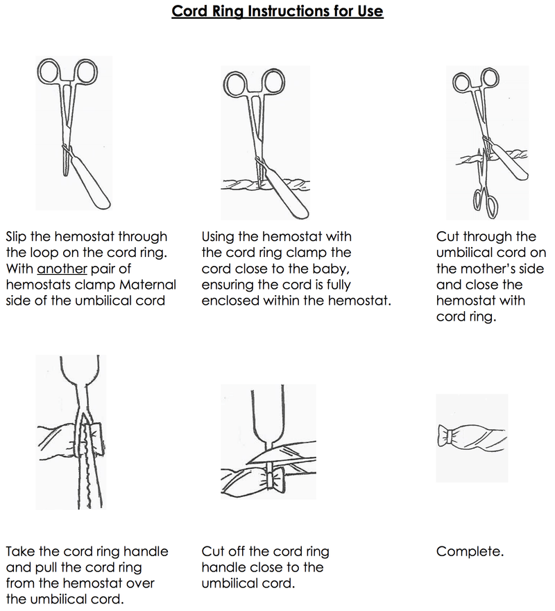 CETRO Cord Rings-IMPORT-DEVICE-Birth Supplies Canada